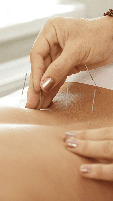 Capacitação em Acupuntura Clássica